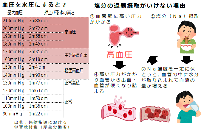 塩分の過剰摂取がいけない理由 血圧を水圧にすると？図と表